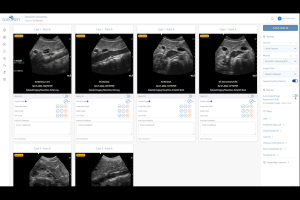 Evaluate ultrasound image acquisition and interpretation